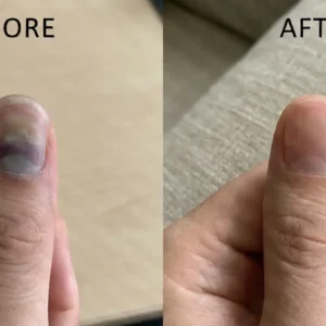 Natravor® NailRescue Bee Venom Spray