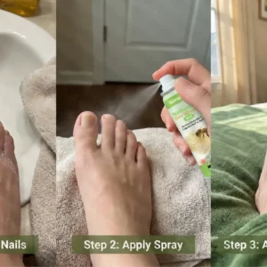 Natravor® NailRescue Bee Venom Spray