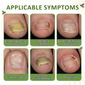 Natravor® NailRescue Bee Venom Spray