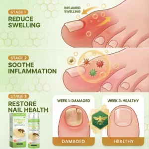 Natravor® NailRescue Bee Venom Spray