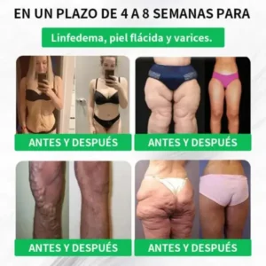 RISARISA® 𝐏𝐚𝐫𝐜𝐡𝐞 𝐝𝐞 𝐌𝐢𝐜𝐫𝐨𝐚𝐠𝐮𝐣𝐚𝐬 𝐍𝐚𝐧𝐨 𝐝𝐞 𝐍𝐀𝐃+ 𝐲 𝐁𝐞𝐫𝐛𝐞𝐫𝐢𝐧𝐚 – 𝐑𝐞𝐦𝐨𝐝𝐞𝐥𝐚𝐜𝐢ó𝐧 𝐂𝐨𝐫𝐩𝐨𝐫𝐚𝐥