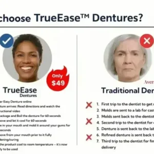 TrueEase™ Dentures