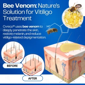 14 PCS Left - Cvreoz® VitiClear Bee Venom Cream | No More Hiding that Skin!💕