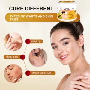 Cvreoz® Bee Venom Mole and Wart Treatment Cream - LIMITED-TIME OFFER | Let out the Best Confidence in YOU!💕