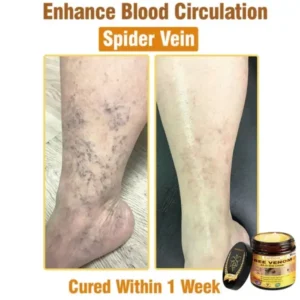 Ealthsn™ Botulinum Toxin & BEE Venom Pain-Relief Bone Healing Cream