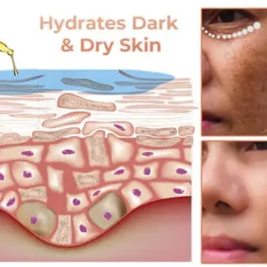 ✨Fast Dark Spot Remover-Natravor®  Melanin Correcting Facial Serum(🔥Last Day Promotion 60% OFF)