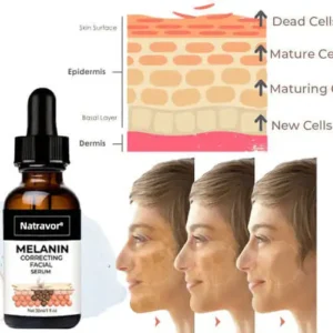 ✨Fast Dark Spot Remover-Natravor®  Melanin Correcting Facial Serum(🔥Last Day Promotion 60% OFF)