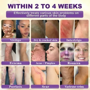 Made and Shipped from USA ✨NATRAVOR® Biotin 10-in-1 Skin Restoration Cream 🍀