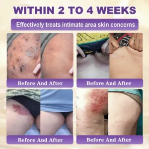 Made and Shipped from USA ✨NATRAVOR® Biotin 10-in-1 Skin Restoration Cream 🍀