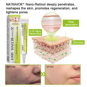 💫NATRAVOR® Skin Tightening & Vita-A Retinol Retinol shot Anti-Wrinkle Firming Tightening cream - Last Day Promotion 70% OFF