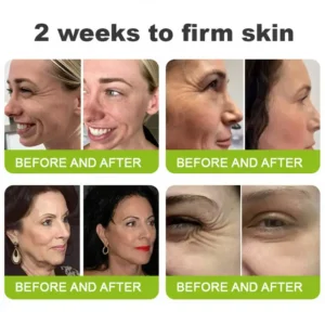 💫NATRAVOR® Skin Tightening & Vita-A Retinol Retinol shot Anti-Wrinkle Firming Tightening cream - Last Day Promotion 70% OFF