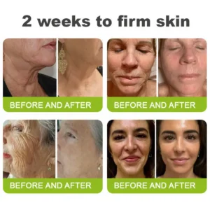 💫NATRAVOR® Skin Tightening & Vita-A Retinol Retinol shot Anti-Wrinkle Firming Tightening cream - Last Day Promotion 70% OFF