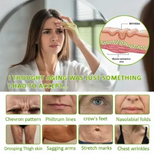 💫NATRAVOR® Skin Tightening & Vita-A Retinol Retinol shot Anti-Wrinkle Firming Tightening cream - Last Day Promotion 70% OFF