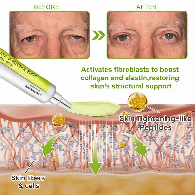 🧠👨⚕️Made and shipped from the USA 💫NATRAVOR® Botox & Vita-A Retinol Shot Wrinkle-Lift Tightening cream - Last Day Promotion 70% OFF