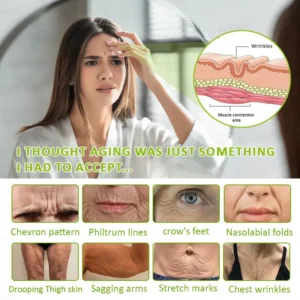 🧠👨⚕️Made and shipped from the USA 💫NATRAVOR® Botox & Vita-A Retinol Shot Wrinkle-Lift Tightening cream - Last Day Promotion 70% OFF