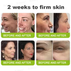 🧠👨⚕️Made and shipped from the USA 💫NATRAVOR® Botox & Vita-A Retinol Shot Wrinkle-Lift Tightening cream - Last Day Promotion 70% OFF