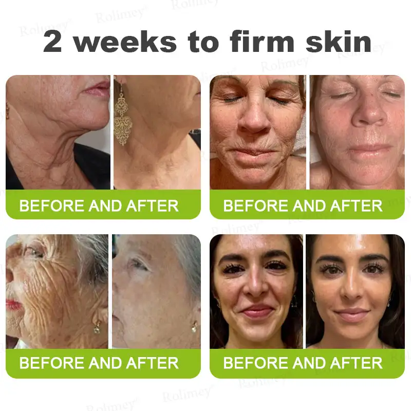 🧠👨⚕️Made and shipped from the USA 💫NATRAVOR® Botox & Vita-A Retinol Shot Wrinkle-Lift Tightening cream - Last Day Promotion 70% OFF