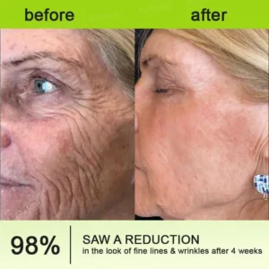 🧠👨⚕️Made and shipped from the USA 💫NATRAVOR® Botox & Vita-A Retinol Shot Wrinkle-Lift Tightening cream - Last Day Promotion 70% OFF