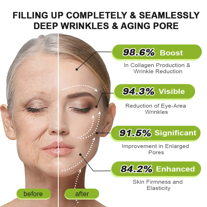 🧠👨⚕️Made and shipped from the USA 💫NATRAVOR® Botox & Vita-A Retinol Shot Wrinkle-Lift Tightening cream - Last Day Promotion 70% OFF
