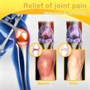 ๐๐๐๐ข๐๐ข๐๐ฅ ๐๐ซ๐๐ง๐ ๐๐ญ๐จ๐ซ๐ | โ
๐ฅ Natravorยฎ Joint Pain Relief Patches โ 40 Mixed Sizes for Knees, Back, Shoulders