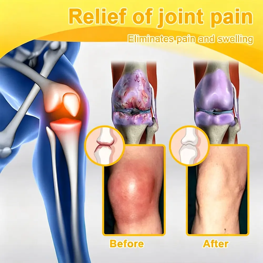 ๐๐๐๐ข๐๐ข๐๐ฅ ๐๐ซ๐๐ง๐ ๐๐ญ๐จ๐ซ๐ | โ
๐ฅ Natravorยฎ Joint Pain Relief Patches โ 40 Mixed Sizes for Knees, Back, Shoulders