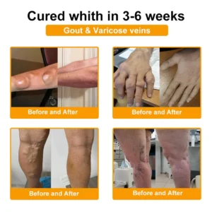 𝐎𝐟𝐟𝐢𝐜𝐢𝐚𝐥 𝐁𝐫𝐚𝐧𝐝 𝐒𝐭𝐨𝐫𝐞 | ✅🔥 Natravor® Joint Pain Relief Patches – 40 Mixed Sizes for Knees, Back, Shoulders