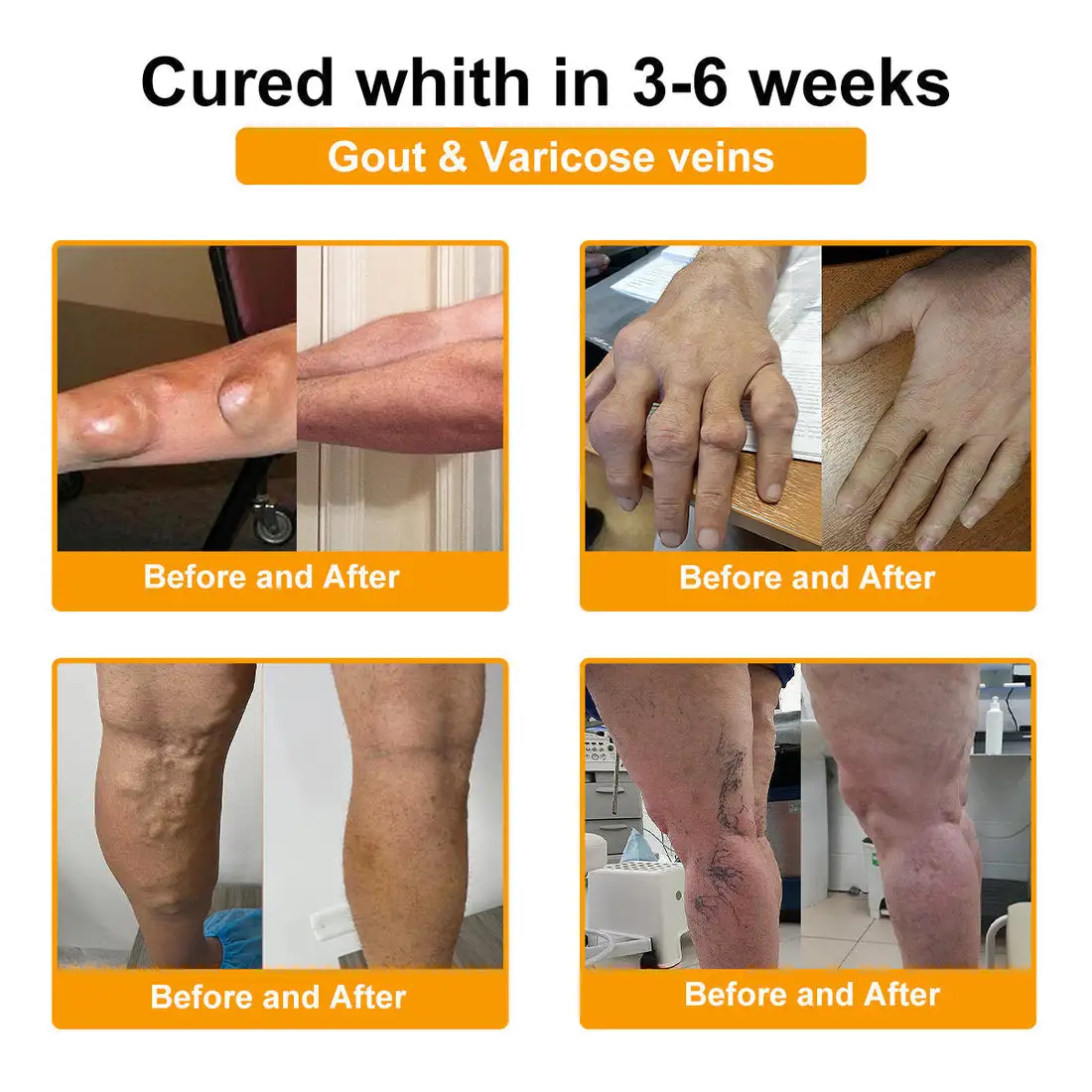 ๐๐๐๐ข๐๐ข๐๐ฅ ๐๐ซ๐๐ง๐ ๐๐ญ๐จ๐ซ๐ | โ
๐ฅ Natravorยฎ Joint Pain Relief Patches โ 40 Mixed Sizes for Knees, Back, Shoulders