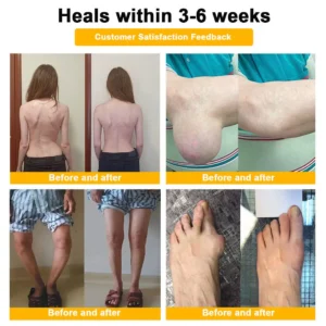 ๐๐๐๐ข๐๐ข๐๐ฅ ๐๐ซ๐๐ง๐ ๐๐ญ๐จ๐ซ๐ | โ
๐ฅ Natravorยฎ Joint Pain Relief Patches โ 40 Mixed Sizes for Knees, Back, Shoulders