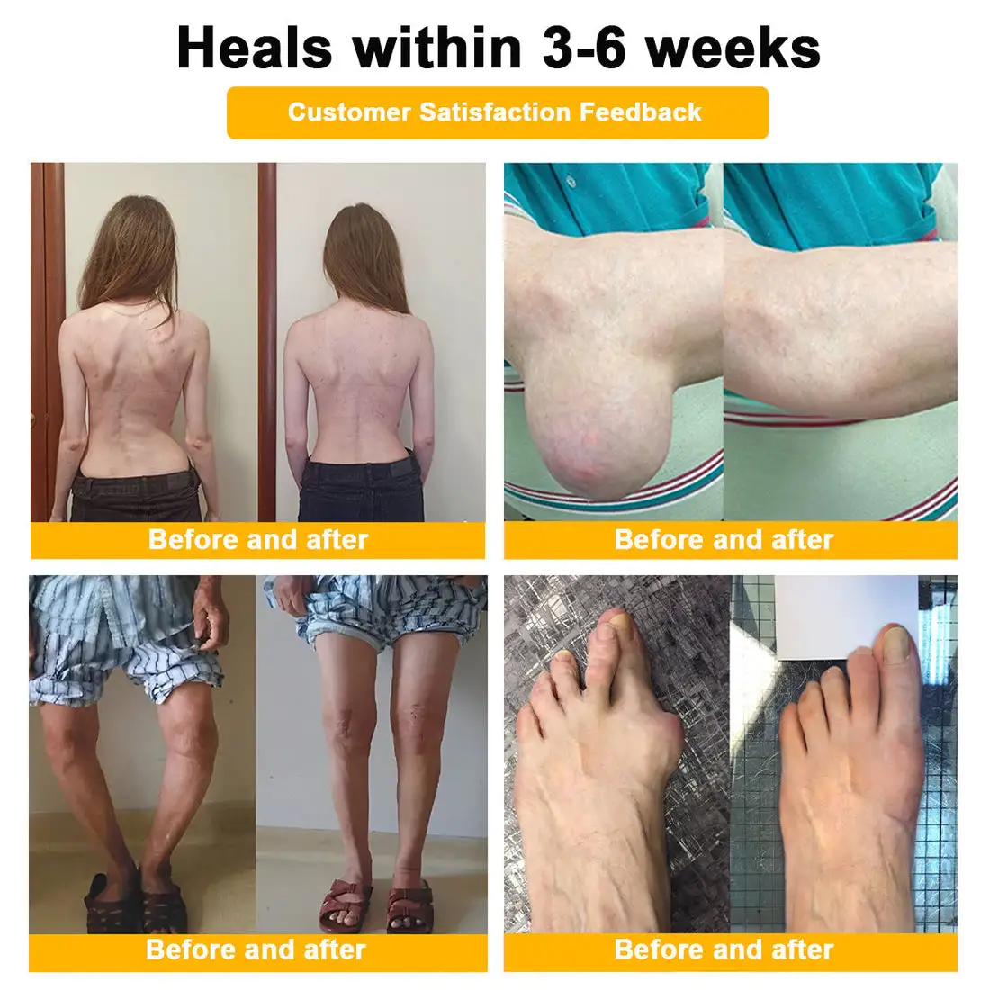 ๐๐๐๐ข๐๐ข๐๐ฅ ๐๐ซ๐๐ง๐ ๐๐ญ๐จ๐ซ๐ | โ
๐ฅ Natravorยฎ Joint Pain Relief Patches โ 40 Mixed Sizes for Knees, Back, Shoulders