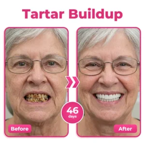 🇺🇸🦷🌟 Natravor® Thismile NH-10 Toothpaste Serum for Enamel & Gum Care –
 – My Store
