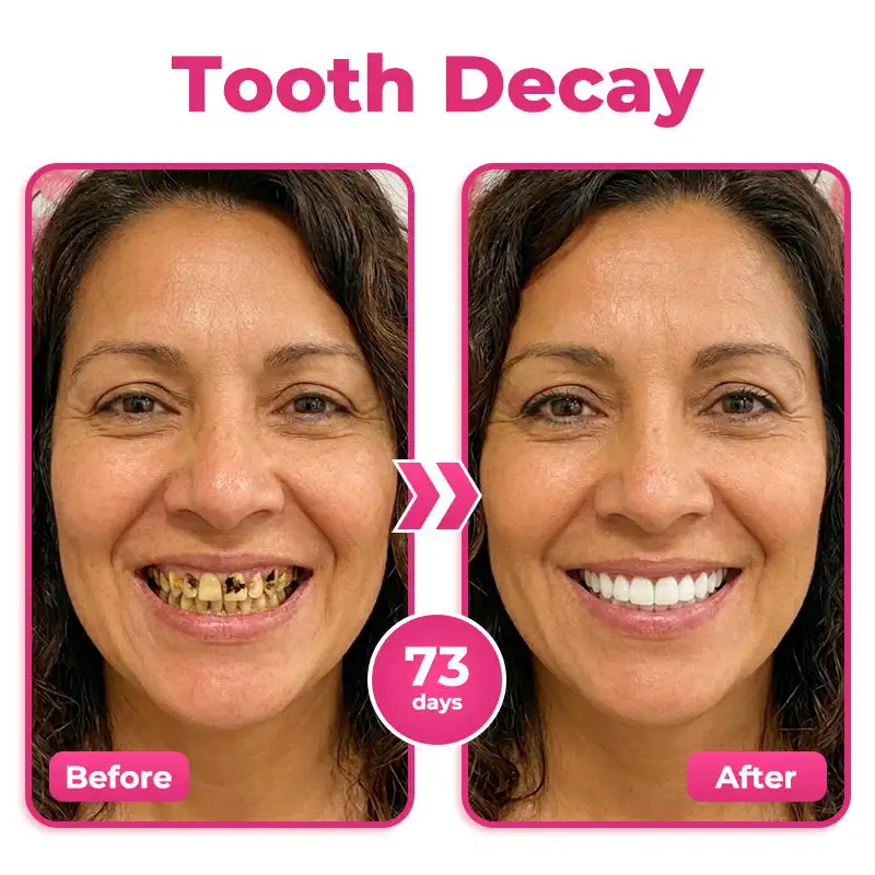 🇺🇸🦷🌟 Natravor® Thismile NH-10 Toothpaste Serum for Enamel & Gum Care –
– My Store