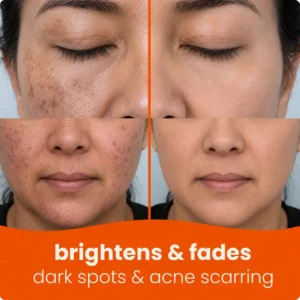 🔥Last Day 68% OFF-NATRAVOR® Turmeric Kojic Glow Pads