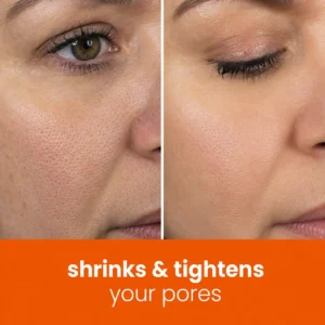 🔥Last Day 68% OFF-NATRAVOR® Turmeric Kojic Glow Pads
