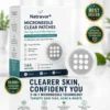 NATRAVOR®2-in-1 Microneedle & Hydrocolloid Patch🍀| Removes Raised Moles, Acne, Flat Warts & Skin Tags | Helps Improve Wrinkles, Scars & Blemishes | Invisible Patches for Face & Body