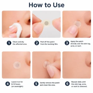 NATRAVOR®2-in-1 Microneedle & Hydrocolloid Patch🍀| Removes Raised Moles, Acne, Flat Warts & Skin Tags | Helps Improve Wrinkles, Scars & Blemishes | Invisible Patches for Face & Body