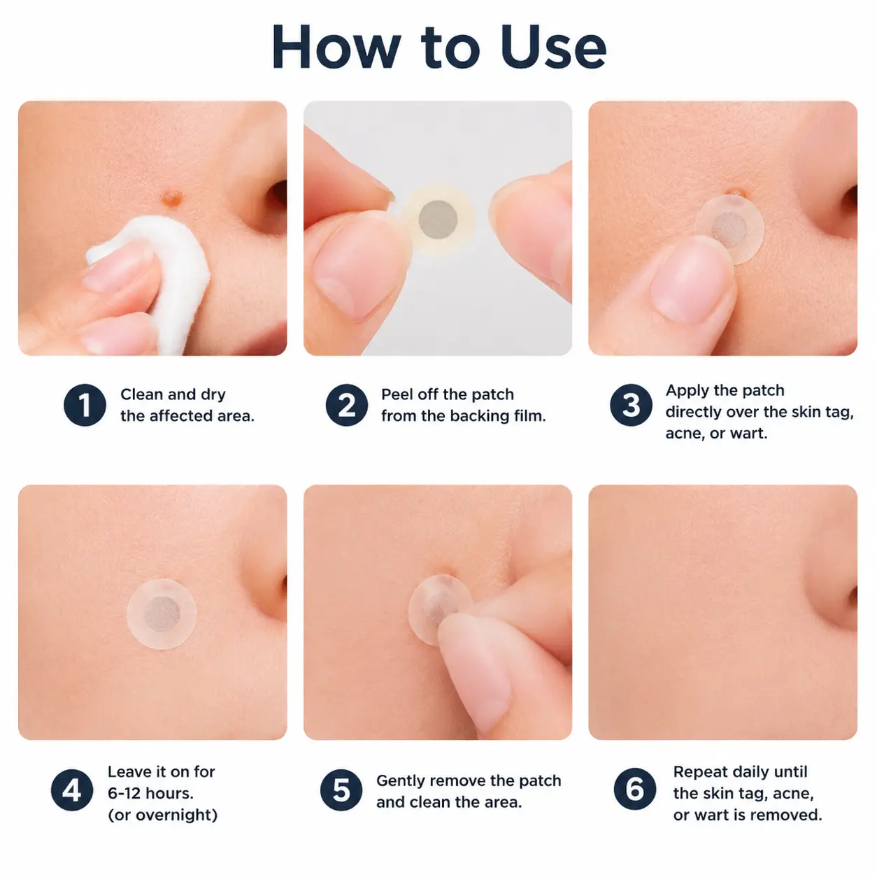 NATRAVOR®2-in-1 Microneedle & Hydrocolloid Patch🍀| Removes Raised Moles, Acne, Flat Warts & Skin Tags | Helps Improve Wrinkles, Scars & Blemishes | Invisible Patches for Face & Body