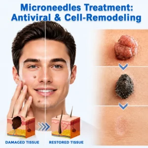 NATRAVOR®2-in-1 Microneedle & Hydrocolloid Patch🍀| Removes Raised Moles, Acne, Flat Warts & Skin Tags | Helps Improve Wrinkles, Scars & Blemishes | Invisible Patches for Face & Body