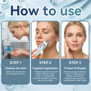 𝐎𝐟𝐟𝐢𝐜𝐢𝐚𝐥 𝐁𝐫𝐚𝐧𝐝 𝐒𝐭𝐨𝐫𝐞 |✅🎉Natravor® 7-Day Tag & Spot Eraser Rollerball |
 – US