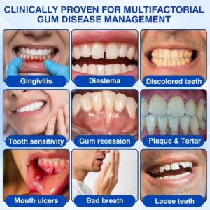 🇺🇸🏅🦷💫𝐍𝐚𝐭𝐫𝐚𝐯𝐨𝐫® GumRevive Periodontal Repair Gel
 – Wepriz