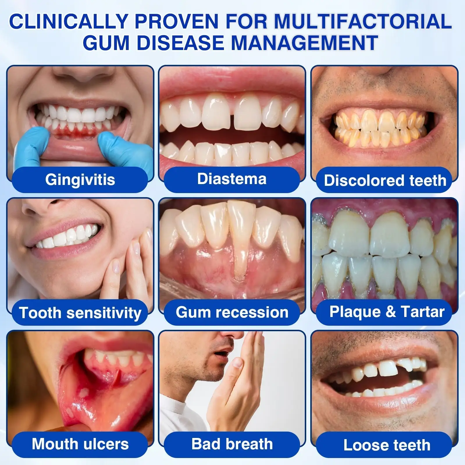 ๐บ๐ธ๐
๐ฆท๐ซ๐๐๐ญ๐ซ๐๐ฏ๐จ๐ซยฎ GumRevive Periodontal Repair Gel
โ Wepriz