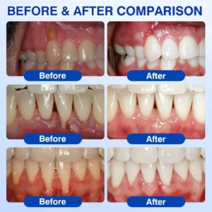 ๐บ๐ธ๐
๐ฆท๐ซ๐๐๐ญ๐ซ๐๐ฏ๐จ๐ซยฎ GumRevive Periodontal Repair Gel
โ Wepriz