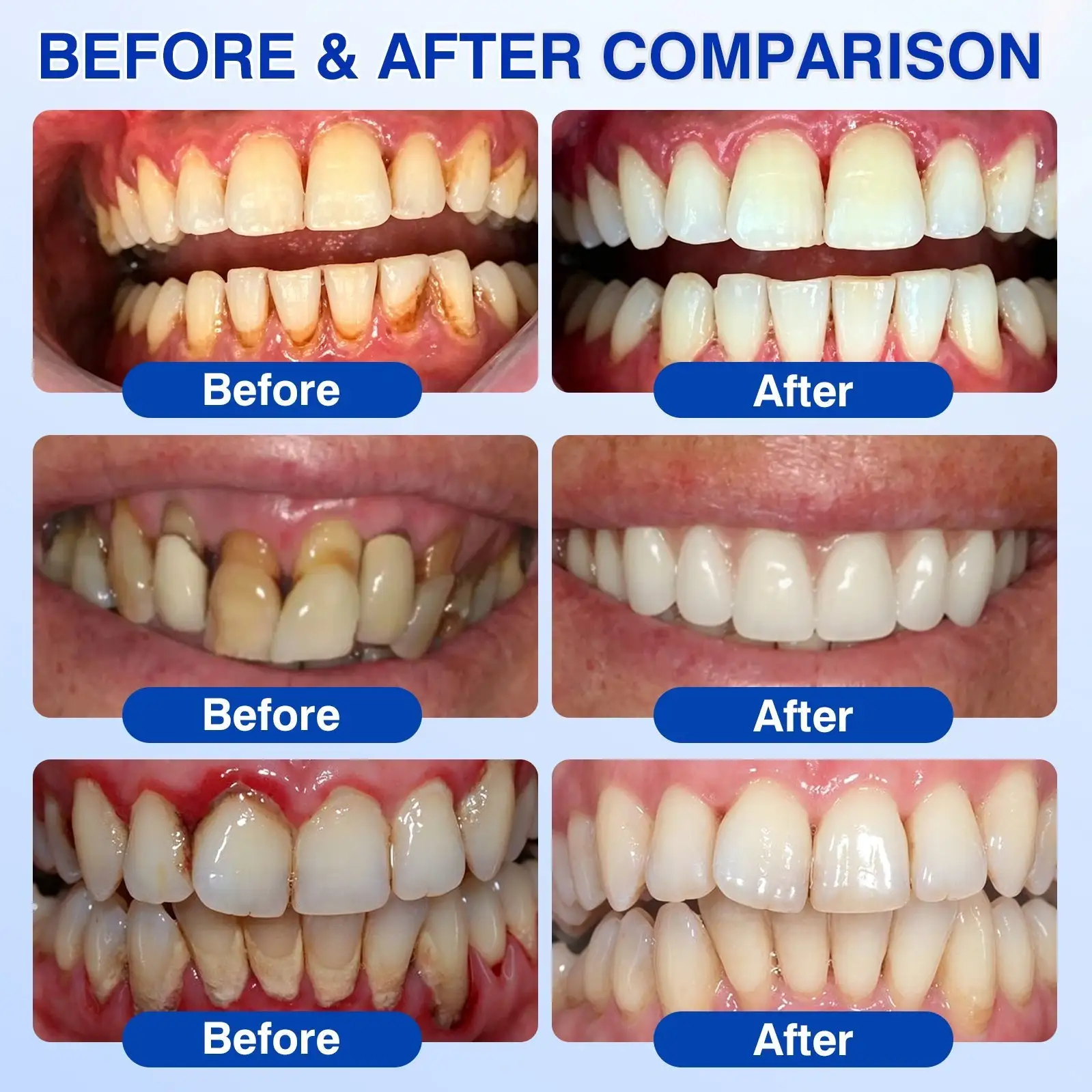 ๐บ๐ธ๐
๐ฆท๐ซ๐๐๐ญ๐ซ๐๐ฏ๐จ๐ซยฎ GumRevive Periodontal Repair Gel
โ Wepriz