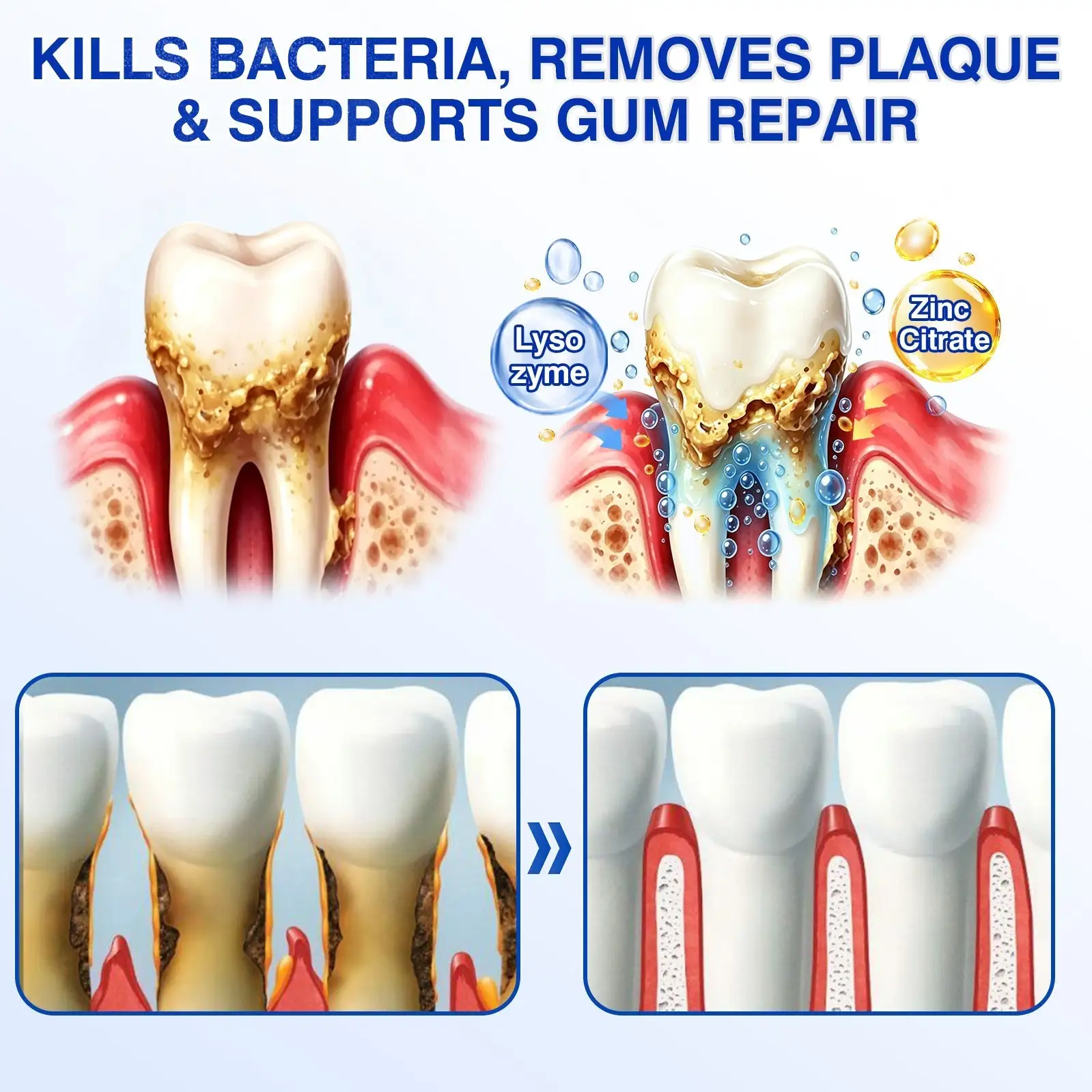 ๐บ๐ธ๐
๐ฆท๐ซ๐๐๐ญ๐ซ๐๐ฏ๐จ๐ซยฎ GumRevive Periodontal Repair Gel
โ Wepriz