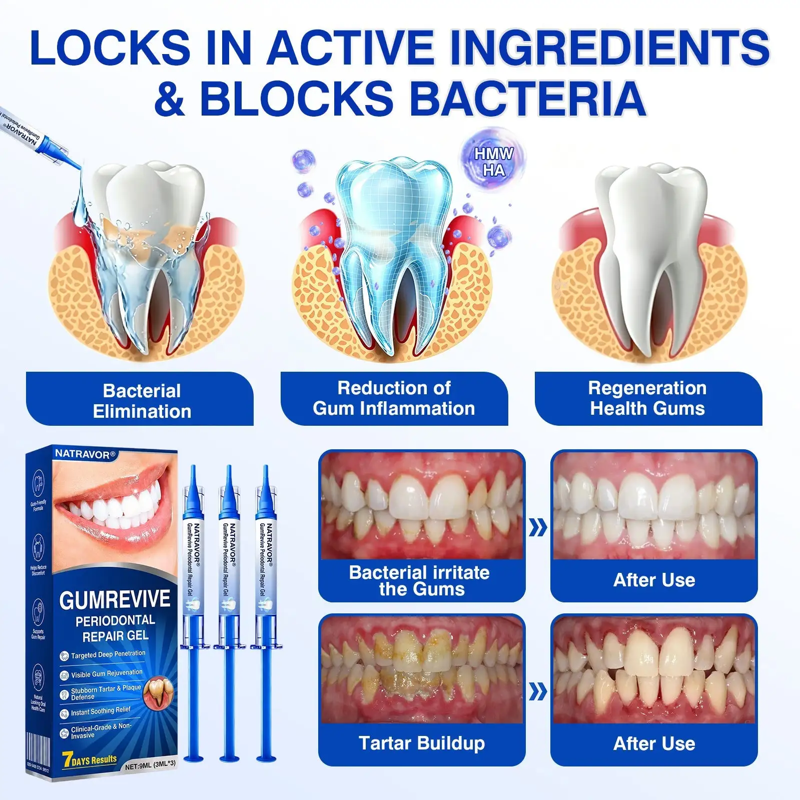 ๐บ๐ธ๐
๐ฆท๐ซ๐๐๐ญ๐ซ๐๐ฏ๐จ๐ซยฎ GumRevive Periodontal Repair Gel
โ Wepriz