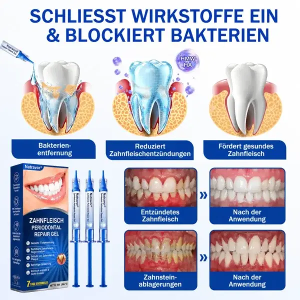 NATRAVOR® GumCare Pro | Zahnfleischpflege & Parodontal Gel