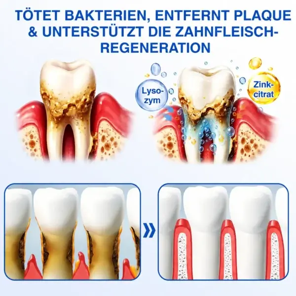 NATRAVOR® GumCare Pro | Zahnfleischpflege & Parodontal Gel