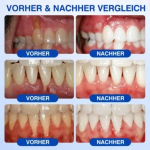NATRAVOR® GumCare Pro | Zahnfleischpflege & Parodontal Gel