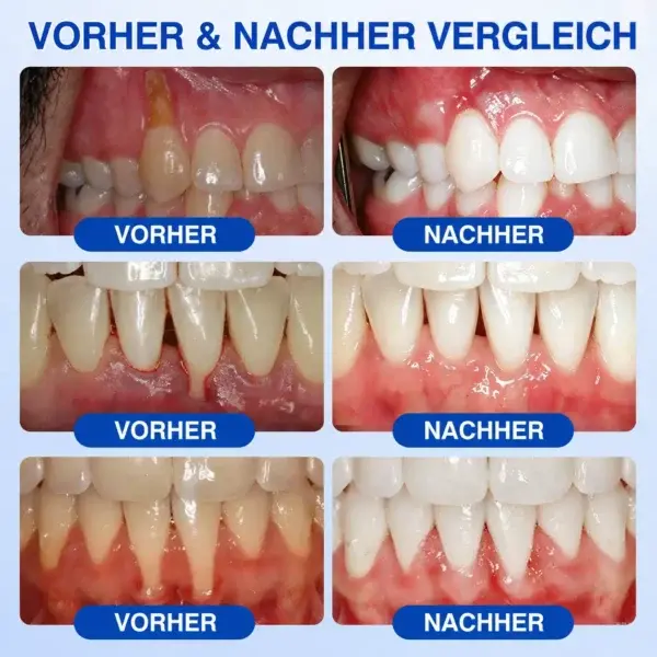 NATRAVOR® GumCare Pro | Zahnfleischpflege & Parodontal Gel