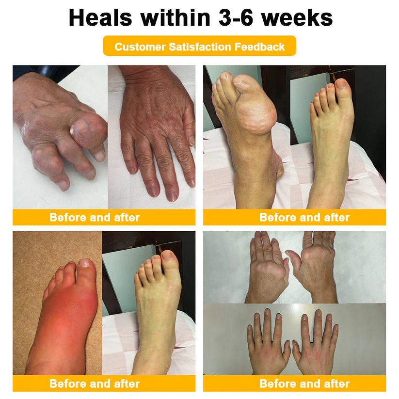 NATRAVOR® Botulinum Toxin & Bee Venom Joint Pain Relief - Image 5