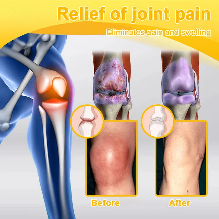 NATRAVOR® Botulinum Toxin & Bee Venom Joint Pain Relief - Image 3